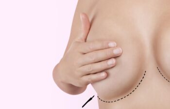 Close-up of a person's chest with one hand lifting a breast; dotted surgical line and a small drawn scalpel appear below, indicating a breast surgery procedure.