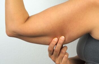 A person pinches the skin on the underside of their upper arm while flexing, highlighting loose or excess skin.